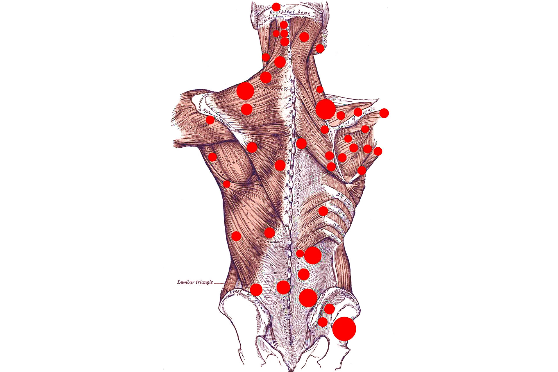 Лечебный массаж по тригерным точкам